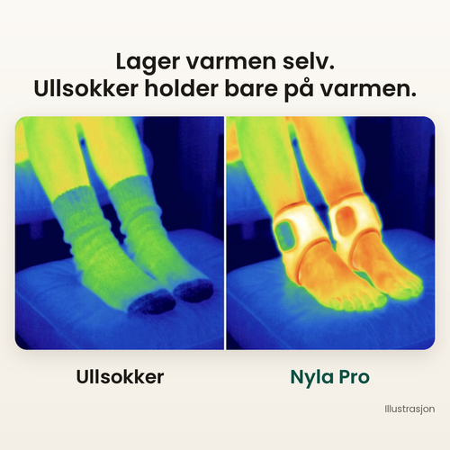 Varmebilde: føtter i ullsokker ved siden av føtter med Nyla Pro. Lager varmen selv. Ullsokker holder bare på varmen. Illustrasjon.