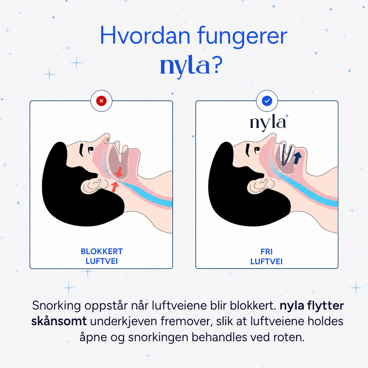 Nyla Pro® justerbar anti-snorkeskinne